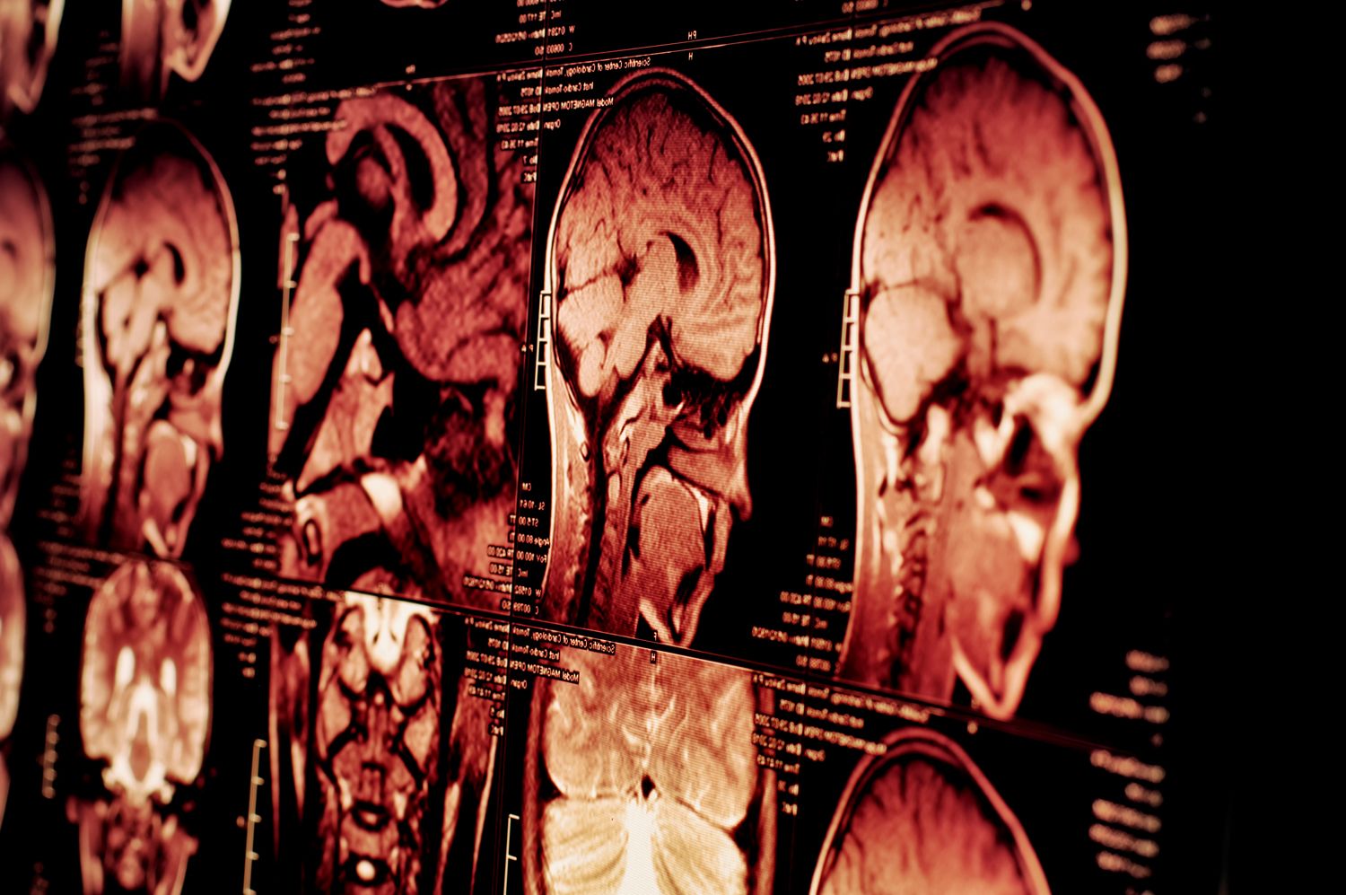 neurologie-vegetativum-herz-kreislau-atemwege-hno-augen-muskel-weichteilschmerzen-anna-arbitmann